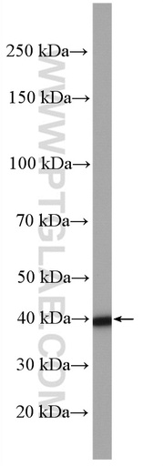 [27973-1-AP-20UL] ALKBH1 Polyclonal antibody