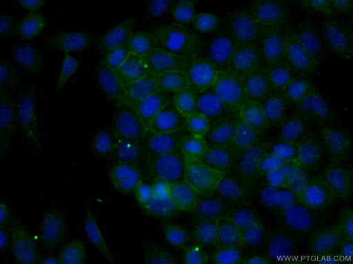 [27980-1-AP-150UL] ANK3 Polyclonal antibody