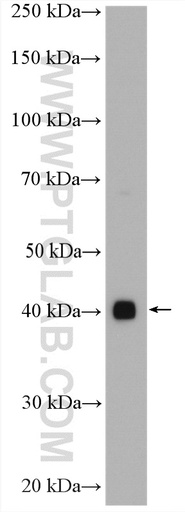 [27984-1-AP-20UL] FAM71F1 Polyclonal antibody