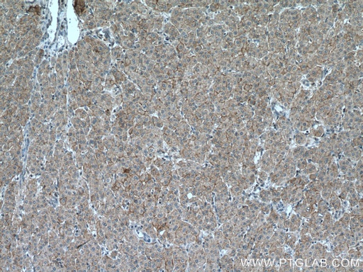 [27998-1-AP-150UL] SLC22A9 Polyclonal antibody