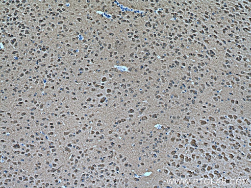 [28007-1-AP-150UL] MAPK8/9/10 Polyclonal antibody