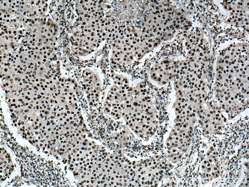 [28016-1-AP-150UL] BPTF Polyclonal antibody