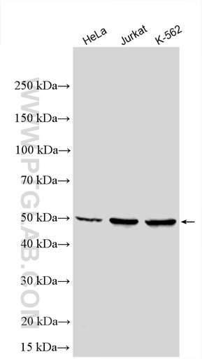 [28018-1-AP-20UL] VRK1 Polyclonal antibody