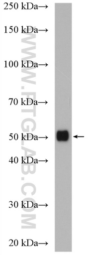 [28019-1-AP-20UL] ZNHIT6 Polyclonal antibody