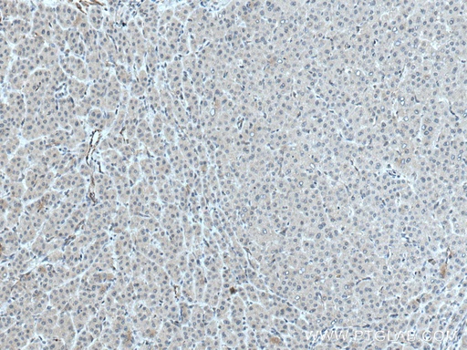 [28021-1-AP-150UL] ATG14 Polyclonal antibody