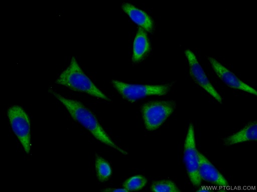 [28030-1-AP-150UL] ATP1A3 (middle) Polyclonal antibody