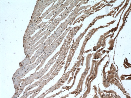 [28034-1-AP-20UL] FADS2-Specific Polyclonal antibody
