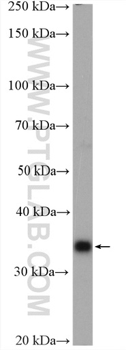 [28035-1-AP-150UL] IL-33 Polyclonal antibody
