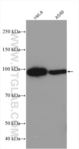 [28039-1-AP-150UL] FBXO30 Polyclonal antibody