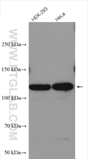 [28040-1-AP-150UL] SMG8 Polyclonal antibody