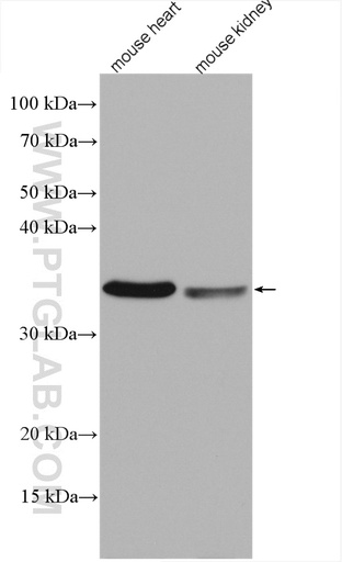 [28051-1-AP-150UL] COQ3 Polyclonal antibody