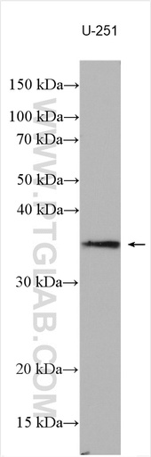 [28078-1-AP-150UL] SEC22C Polyclonal antibody