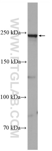 [28079-1-AP-20UL] SCN1A Polyclonal antibody