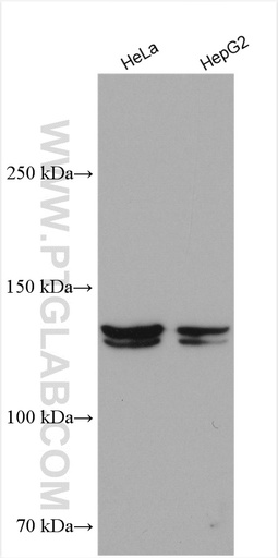 [28085-1-AP-150UL] NPC1L1 Polyclonal antibody