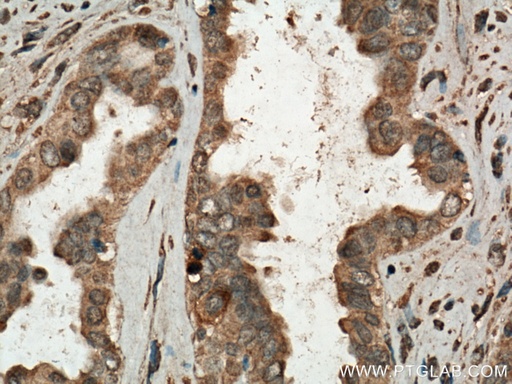 [28109-1-AP-20UL] CDC25B Polyclonal antibody