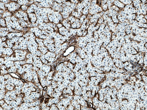 [28117-1-AP-20UL] Endoglin/CD105 Polyclonal antibody