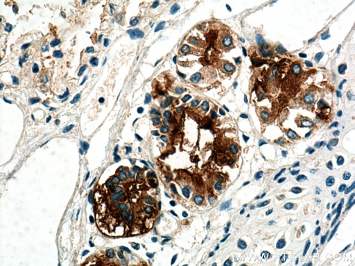 [28118-1-AP-150UL] MUC5B Polyclonal antibody