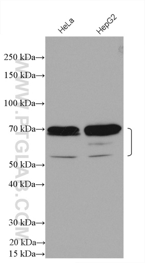 [28127-1-AP-150UL] ZBTB7B Polyclonal antibody