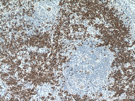[28131-1-AP-20UL] band 3/ AE1 Polyclonal antibody