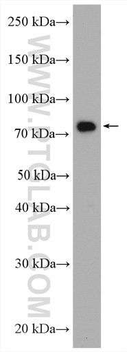 [28133-1-AP-150UL] POLH Polyclonal antibody