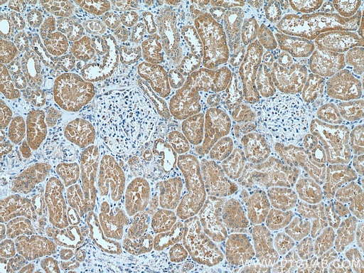 [28137-1-AP-20UL] C3orf31 Polyclonal antibody