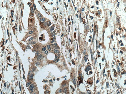[28150-1-AP-150UL] SGSH Polyclonal antibody