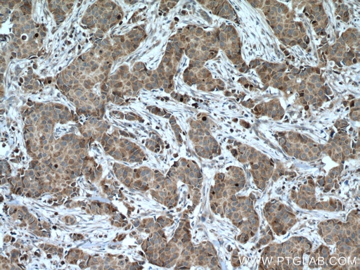 [28152-1-AP-150UL] CCDC71 Polyclonal antibody