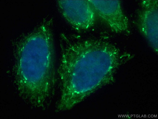 [28165-1-AP-20UL] MRPL39 Polyclonal antibody