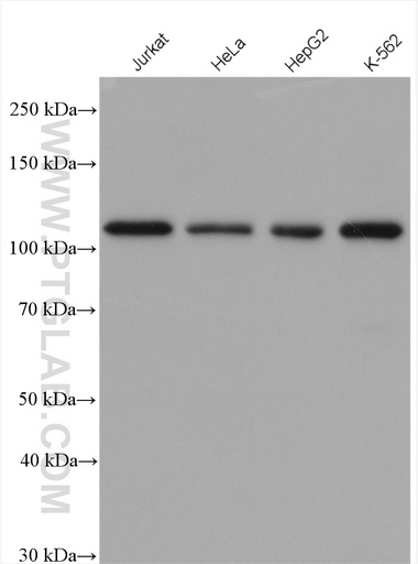 [28186-1-AP-150UL] PMS1 Polyclonal antibody