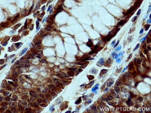 [28194-1-AP-20UL] FES Polyclonal antibody