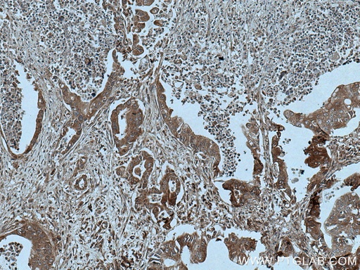[28201-1-AP-20UL] ASK1 Polyclonal antibody