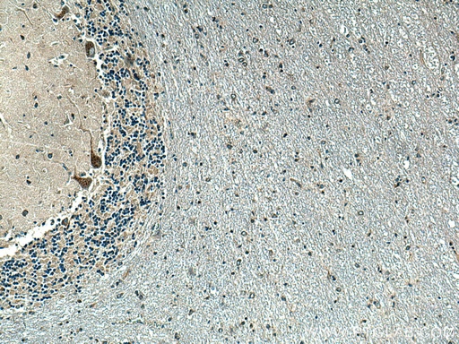 [28207-1-AP-150UL] P2RX7 Polyclonal antibody