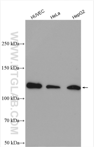 [28212-1-AP-20UL] SREBF2 Polyclonal antibody