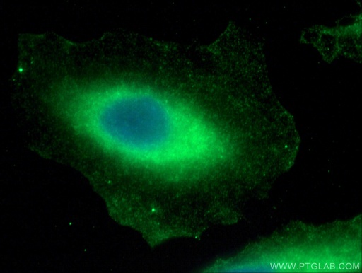 [28216-1-AP-20UL] TTC12 Polyclonal antibody
