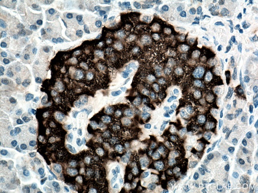 [28219-1-AP-150UL] PCSK1 Polyclonal antibody