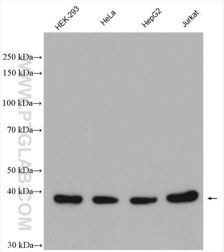[28237-1-AP-20UL] KTI12 Polyclonal antibody