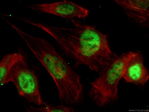 [28248-1-AP-150UL] p21 Polyclonal antibody