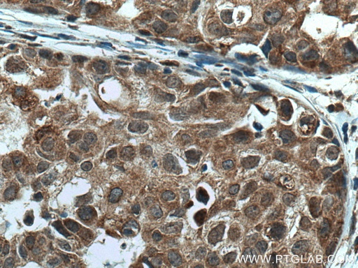 [28263-1-AP-150UL] TMEM192 Polyclonal antibody