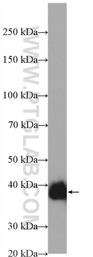 [28271-1-AP-20UL] SFRP1 Polyclonal antibody
