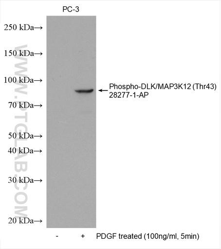 [28277-1-AP-100UL] Phospho-DLK/MAP3K12 (Thr43) Polyclonal antibody