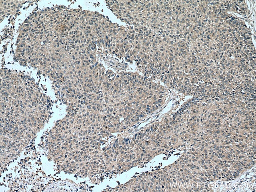 [28283-1-AP-20UL] TSG101 Polyclonal antibody