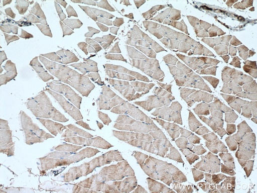 [28315-1-AP-150UL] SCN4A Polyclonal antibody