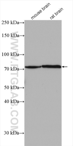 [28316-1-AP-20UL] EOMES/TBR2 Polyclonal antibody