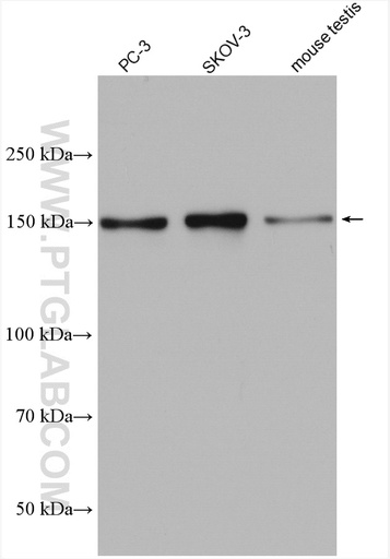 [28318-1-AP-150UL] PDS5B Polyclonal antibody