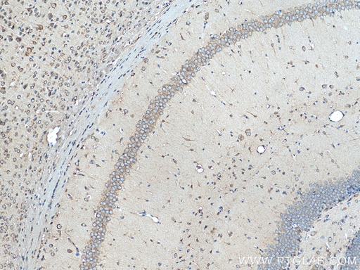 [28322-1-AP-20UL] GIPR Polyclonal antibody