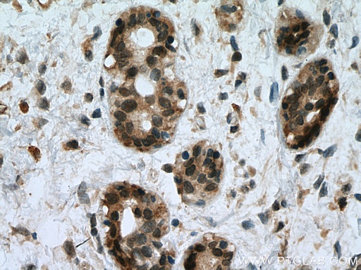 [28328-1-AP-20UL] UBE2D1/2/3/4 Polyclonal antibody