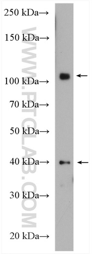 [28356-1-AP-20UL] MTBP Polyclonal antibody