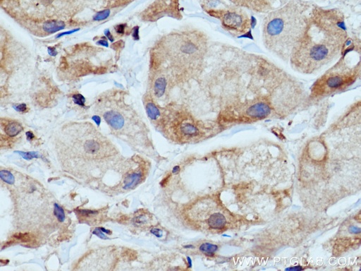 [28357-1-AP-150UL] WNK1 Polyclonal antibody