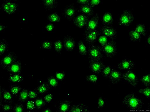 [28366-1-AP-150UL] BOP1 Polyclonal antibody