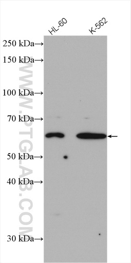 [28367-1-AP-20UL] ST6GAL2 Polyclonal antibody